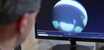 Uzmanlardan kritik uyarı: İdrardaki kanı hafife almayın