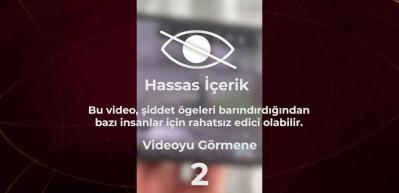 İngiltere'de sokak ortasında kanlı saldırı: 17 yaşındaki kız boynundan bı&ccedil;aklandı