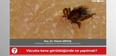 Uzman isimden kene uyarısı: V&uuml;cuttan en kısa s&uuml;rede uzaklaştırılmalı!