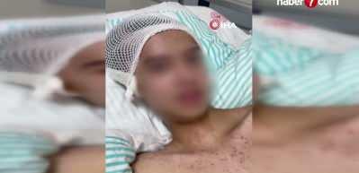  Tacize direndiği iddiasıyla başından vurulan &ccedil;ocuk fel&ccedil; kaldı