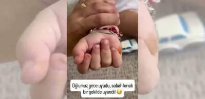 Sosyal medyada g&uuml;ndem oldu! &Ccedil;ocuğunun el ve ayaklarındaki renk değişiminin nedeni şaşırttı