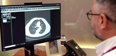 Uzmanı a&ccedil;ıkladı: Enfeksiyon sepsise d&ouml;n&uuml;şmeden &ouml;nce bu belirtilere dikkat