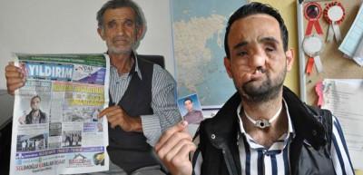 Oğlu y&uuml;z nakli olan babanın dramı