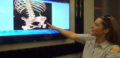  Ameliyatta karnında unutan makasla 6 ay yaşadı