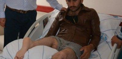 Bacağını ters diktiler!