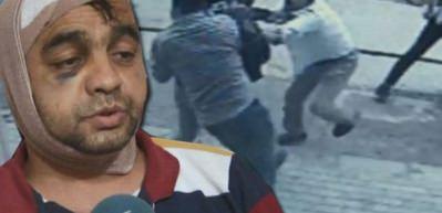 Başkent&rsquo;te gazi ve kardeşine &ccedil;irkin saldırı kamerada