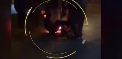 Bı&ccedil;ak &ccedil;eken tinerciyi ateşe verdi!