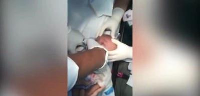 &Ccedil;ocuğun boğazına ka&ccedil;an saat kordonu b&ouml;yle &ccedil;ıkarıldı!