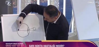 Dr. Feridun Kunak Sarı Nokta Hastalığı Ve Tedavisi hakkında konuştu