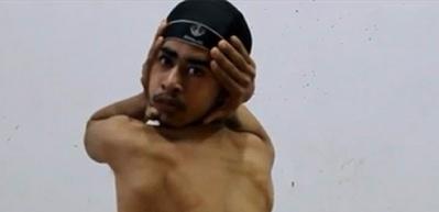 Elastik insan Jaspreet Singh Kalra