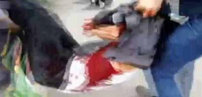 Esed havadan dehşet sa&ccedil;tı: 39 &ouml;l&uuml;!