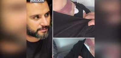 Estetik mağduru olan Alişan Adliye'de 