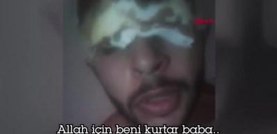 Ka&ccedil;ırılan gence yapılan işkencenin g&ouml;r&uuml;nt&uuml;leri ortaya &ccedil;ıktı