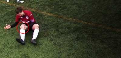Kadın futbolcu &ccedil;ıkan diz kapağını yerine oturtup ma&ccedil;a devam etti!