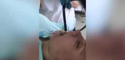 Kadının ağzından giren yılan ameliyatla &ccedil;ıkartıldı
