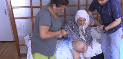 Karnındaki dev k&uuml;tleyle 46 yıldır yaşıyor