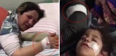 PKK yandaşlarının 'Afrin'de siviller &ouml;l&uuml;yor' tiyatrosu g&uuml;ld&uuml;rd&uuml;