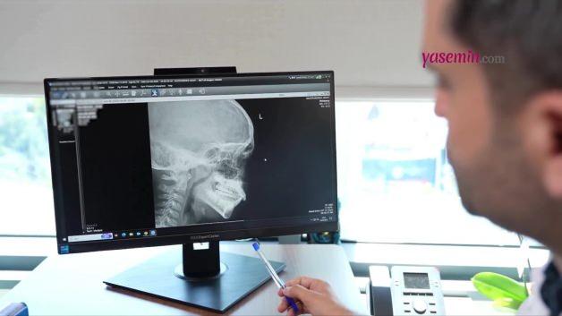 Çocuklarda horlamaya dikkat! Bir yardım çağrısı olabilir