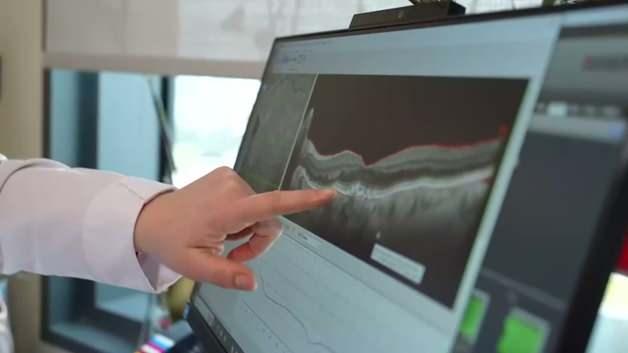 Göz sağlığı ile ilgili önemli uyarı: Sarı nokta hastalığına dikkat!