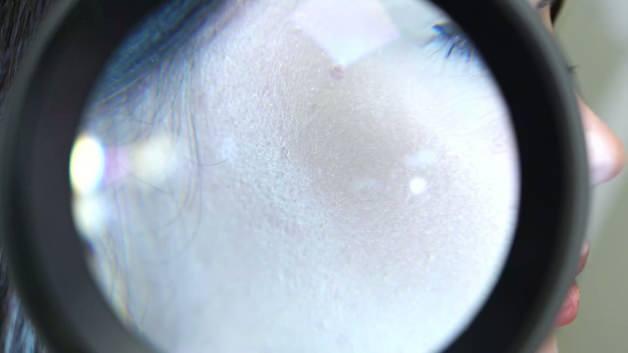 Kış aylarına karşı etkili cilt bakımı önerileri! Kuru, kızarık ve kaşıntılı ciltlere çözüm