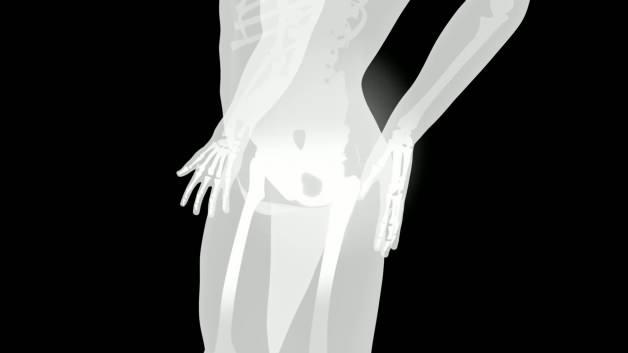 Bebeklerde doğuştan kal&ccedil;a &ccedil;ıkığına karşı erken tanı ve m&uuml;dahale hayati &ouml;nem taşıyor