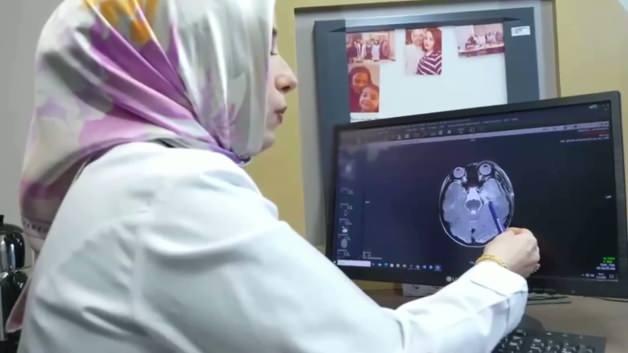 Uzmanından ailelere kritik uyarı: Epilepside g&ouml;zden ka&ccedil;an 5 gizli işaret