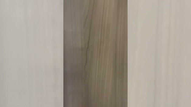 Ufuk &Ouml;zkan'ın nakil &ouml;ncesi g&ouml;r&uuml;nt&uuml;leri ortaya &ccedil;ıktı! 'Ş&uuml;k&uuml;r yaşlarını asla unutmayacağız'