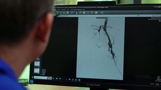 Kritik uyarı: Bacağınız kalp krizi ge&ccedil;iriyor olabilir mi?