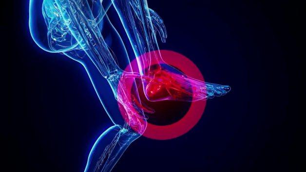 Kronik topuk dikeninde &ccedil;ığır a&ccedil;an y&ouml;ntem: Anjiyografik m&uuml;dahale