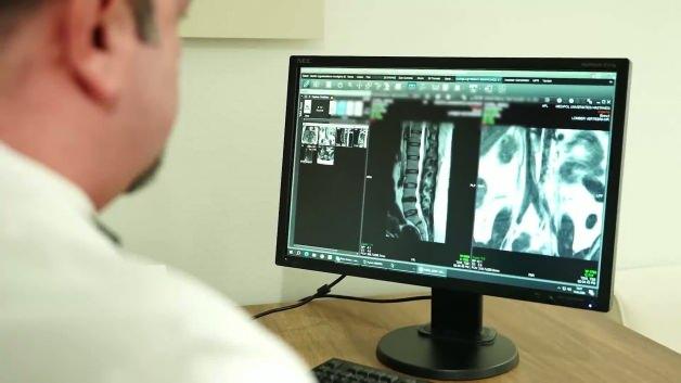 Ge&ccedil;meyen kronik ağrılara &ccedil;&ouml;z&uuml;m: Omurilik pili ve DREZ ameliyatı ile tedavi