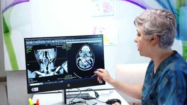 Boğazındaki nadir t&uuml;m&ouml;r nefesini kesti! İki ameliyatla hayata tutundu