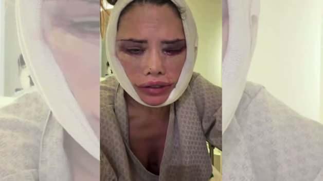 Didem Ceran ikinci kez y&uuml;z ameliyatı oldu! G&ouml;zyaşlarıyla isyan etti