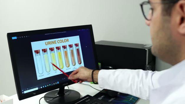 Sakın ihmal etmeyin! İdrar rengi bir&ccedil;ok hastalığın sinyalini veriyor