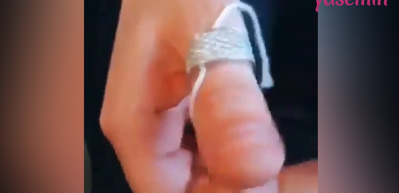 Sıkışan yüzüğü parmaktan çıkarmanın pratik yolları