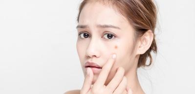 Sivilceyi ge&ccedil;iren besinler