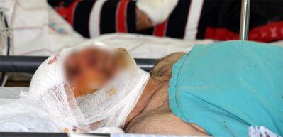 Sokak k&ouml;peği dehşet sa&ccedil;tı