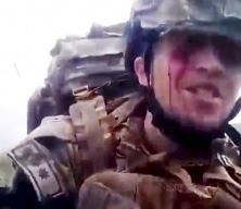 Karabağ'da yaralı halde çektiği videoyla duygulandıran askerin ölmediği ortaya çıktı!