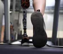Biyonik bacak doğal  yürüme hızını sağlıyor