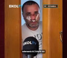 Marmaray'da çocuklarının yanında darp edilen adam ilk defa konuştu: Burnum kırıldı, çocuklarımın psikolojisi çok bozuk