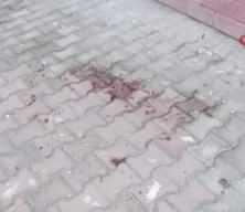 Komşusunun balkonundan kendi evine geçmeye çalışırken düşen kadın ağır yaralandı