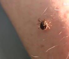 Sağlık Bakanlığı'ndan kene uyarısı