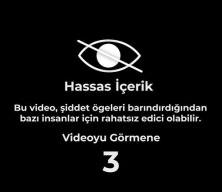 Bayern Münih'in yıldızının ayağı kırıldı!