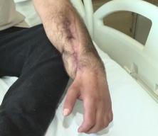 Elektrik akımına kapılan işçi, doku nakliyle dört uzvunu kaybetmekten kurtuldu