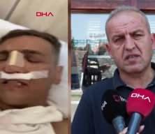 Yine aynı hastane yine ölüm! Burun ameliyatı sonrası fenalaştı ve...