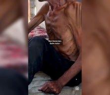 Gazze Şeridi'nde 75 yaşındaki yaşlı adam, İsrail'in dayattığı açlık nedeniyle 40 kiloya düştü