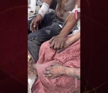 İsrail’in saldırılarının ortasında el ele hayatta kalma mücadelesi veren aile yürekleri yaktı