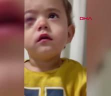 Bursa'da torpil faciası! 2 yaşındaki çocuk gözünden oldu