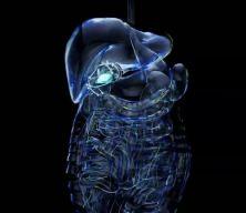 Hazımsızlık deyip geçmeyin: Altında safra kesesi taşı olabilir