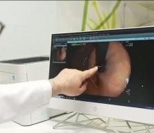 İshaliniz Geçmiyorsa Dikkat! Tek Nedeni Enfeksiyon Olmayabilir