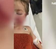 Ankara’da pitbull saldırısı: iki kardeş yaralandı